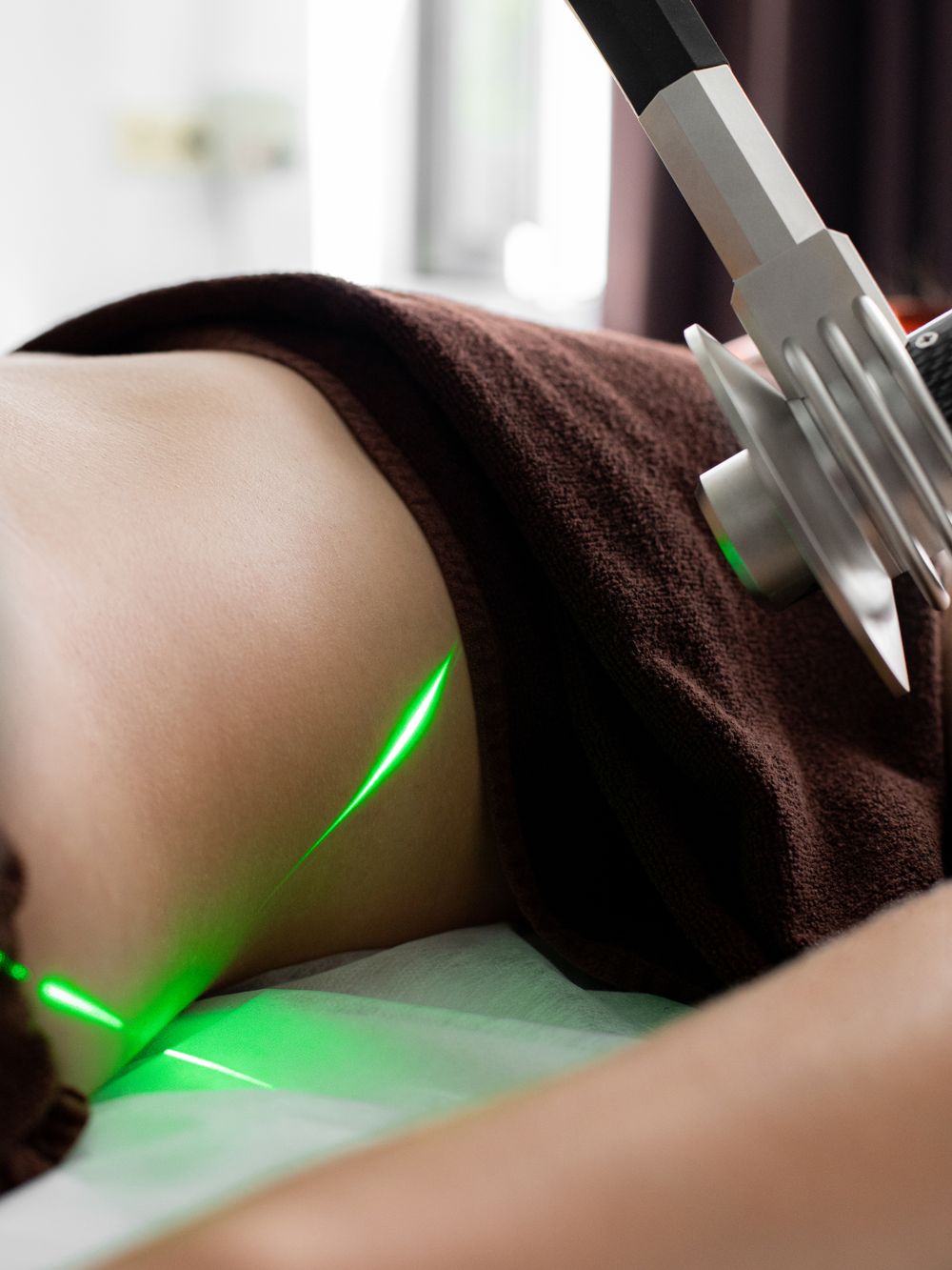 CO2 Laser